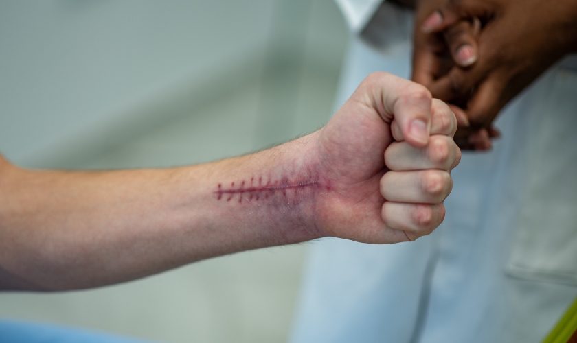 graston massage in Canoga Park